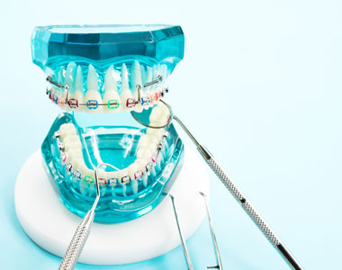 Braces- treatment at Martinsville Family Dentistry  