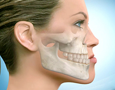 Causes and Treatments for Underbite- treatment at Martinsville Family Dentistry