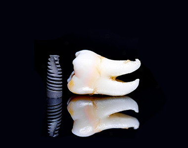 Zygomatic implants- treatment at Martinsville Family Dentistry  