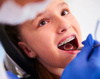 Types of Braces: Which One is Right for You?- treatment at Martinsville Family Dentistry  